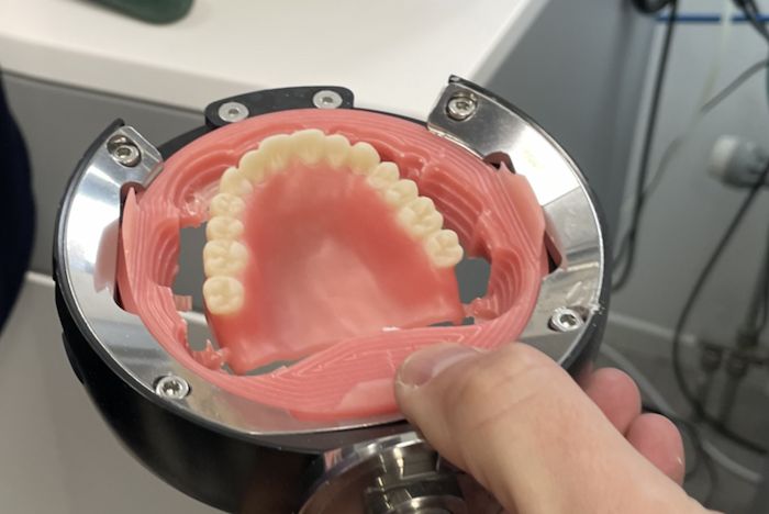 PMMA Resin Discs: The Diverse Radiance in Dental Applications